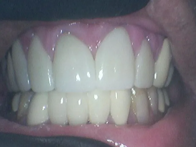 After Image