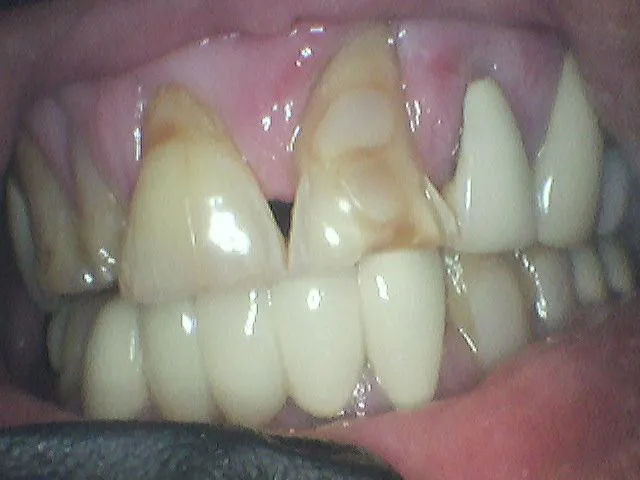 Before Image