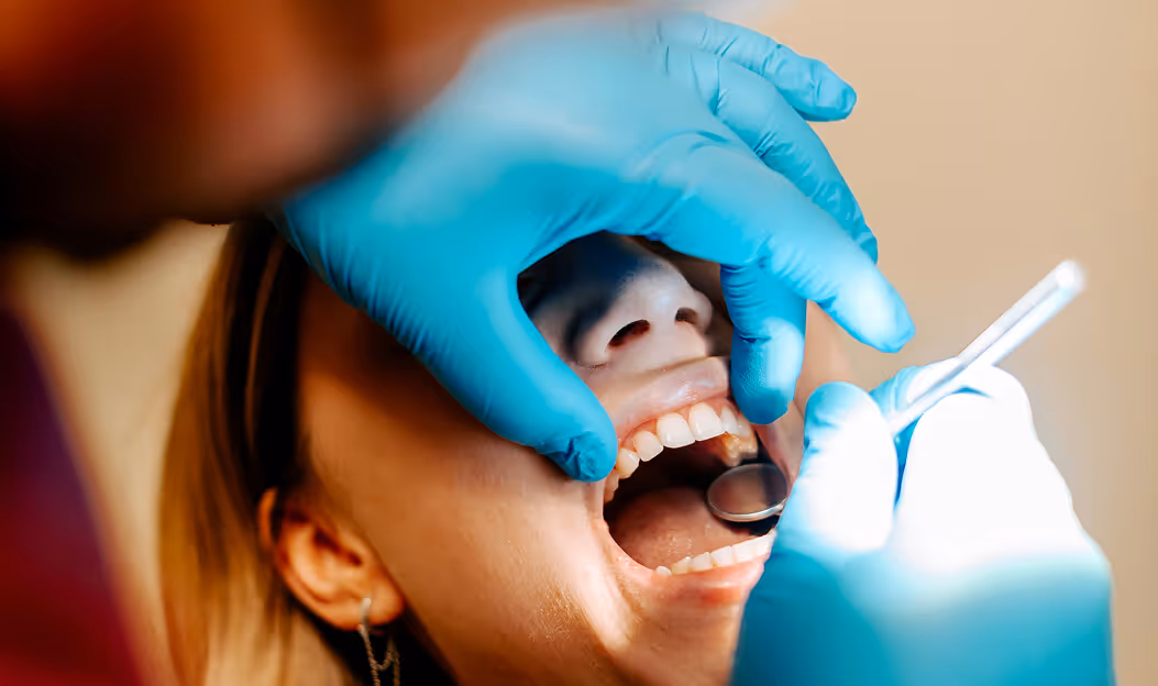 Bild Nahaufnahme eines Zahnarztes mit blauen Handschuhen, der das offene Mundinnere einer Patientin mit einem Mundspiegel untersucht.