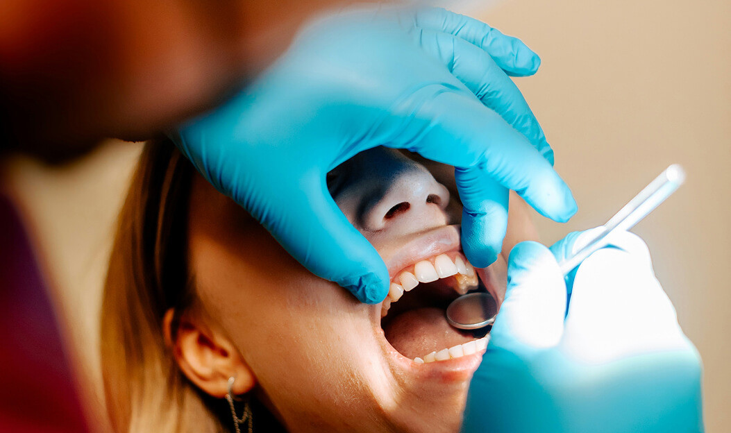 Bild Nahaufnahme eines Zahnarztes mit blauen Handschuhen, der das offene Mundinnere einer Patientin mit einem Mundspiegel untersucht.