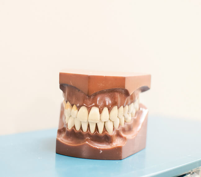 Bild Zahnmodell eines menschlichen Gebisses mit Ober- und Unterkiefer auf blauem Tisch.