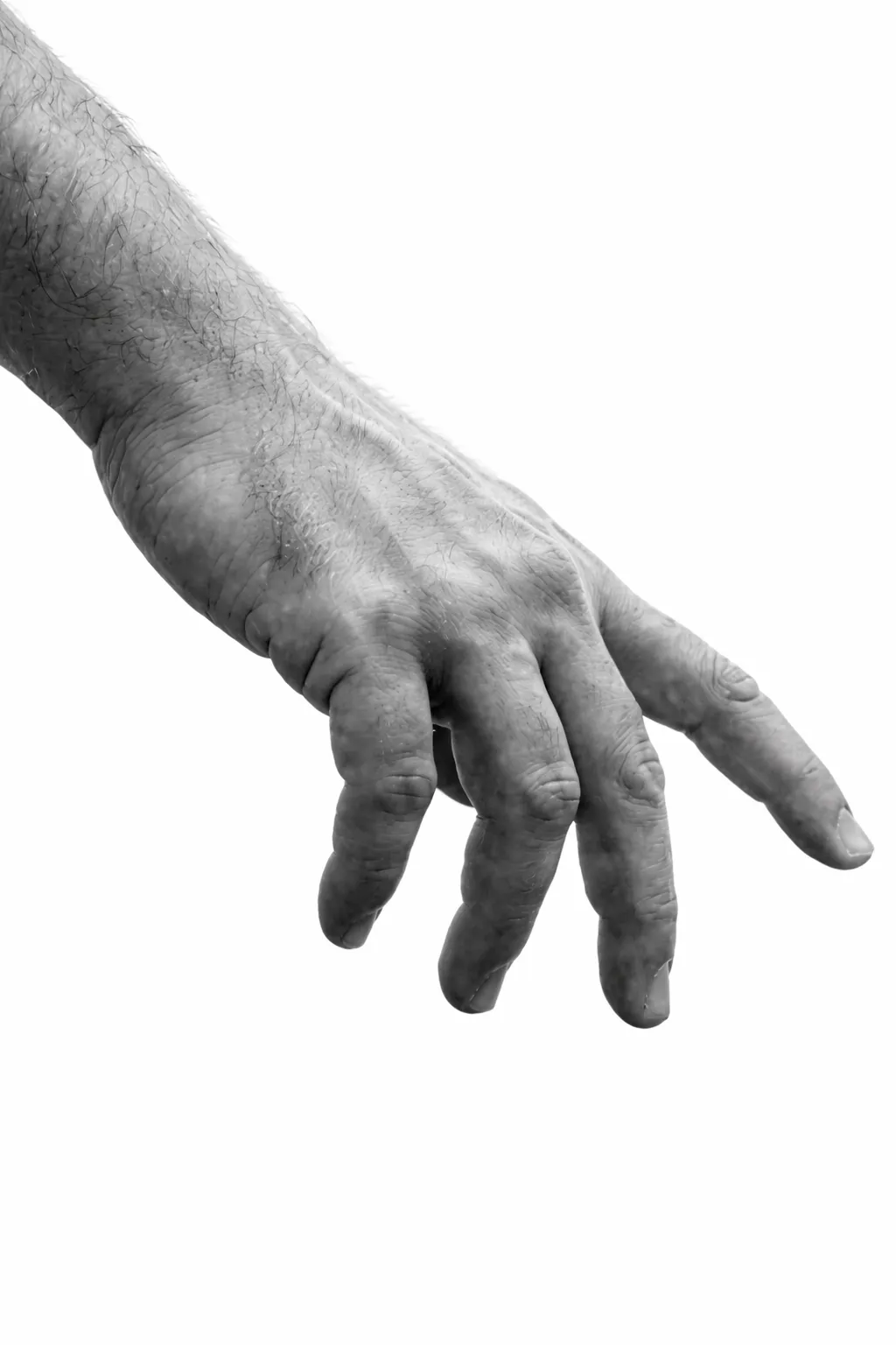 Black and white image of an elderly hand with bent fingers on a white background.