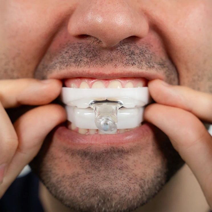 a man's face with a dental overlay