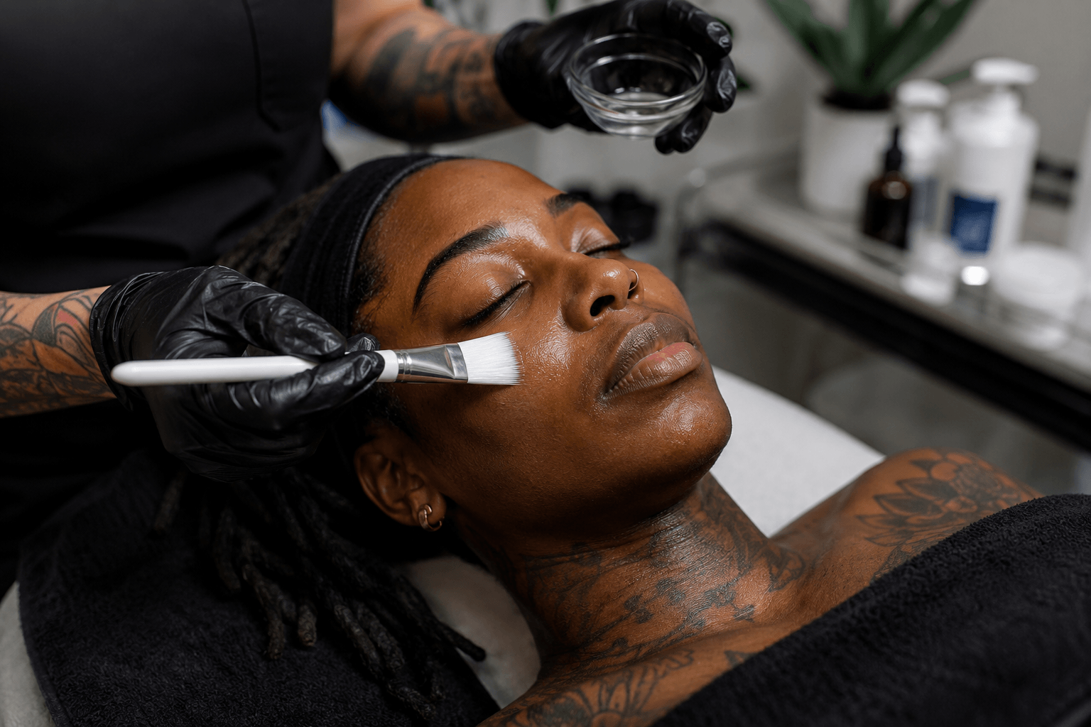 Person with dark skin tone receiving a chemical peel treatment in Atlanta clinic