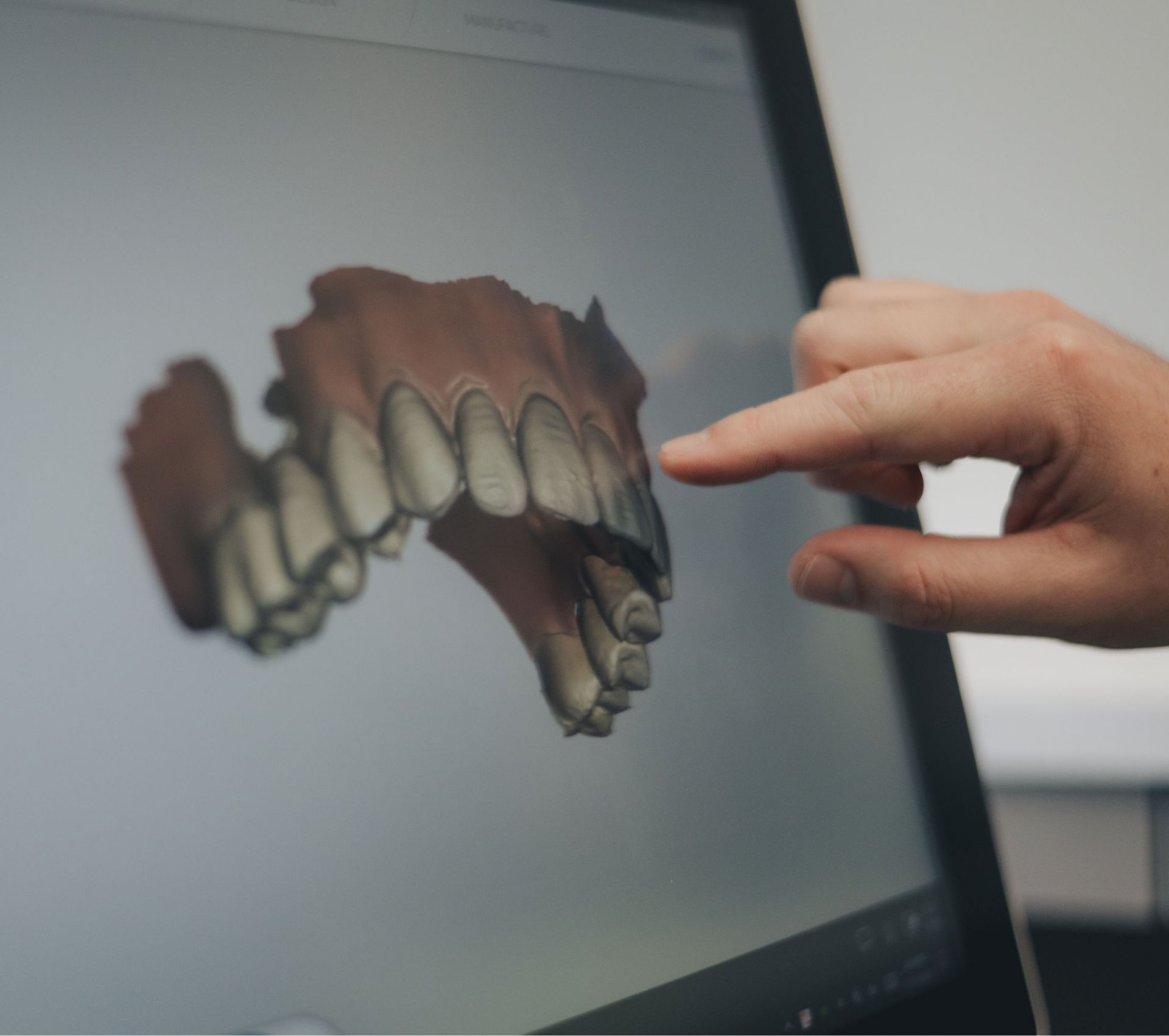 A hand pointing at a 3D digital model of a set of upper teeth displayed on a computer screen.