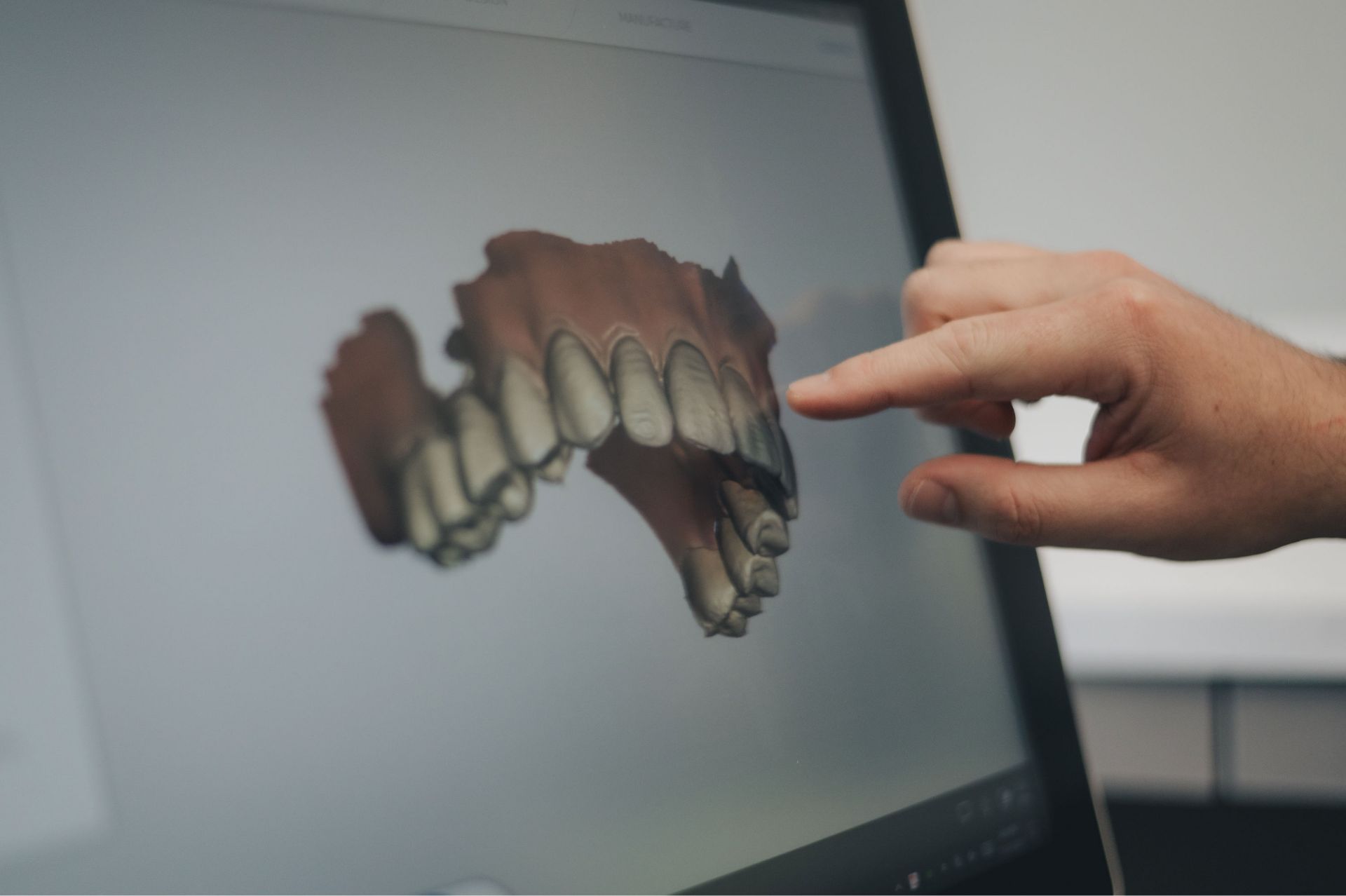 A hand pointing at a 3D digital model of upper teeth displayed on a computer screen.