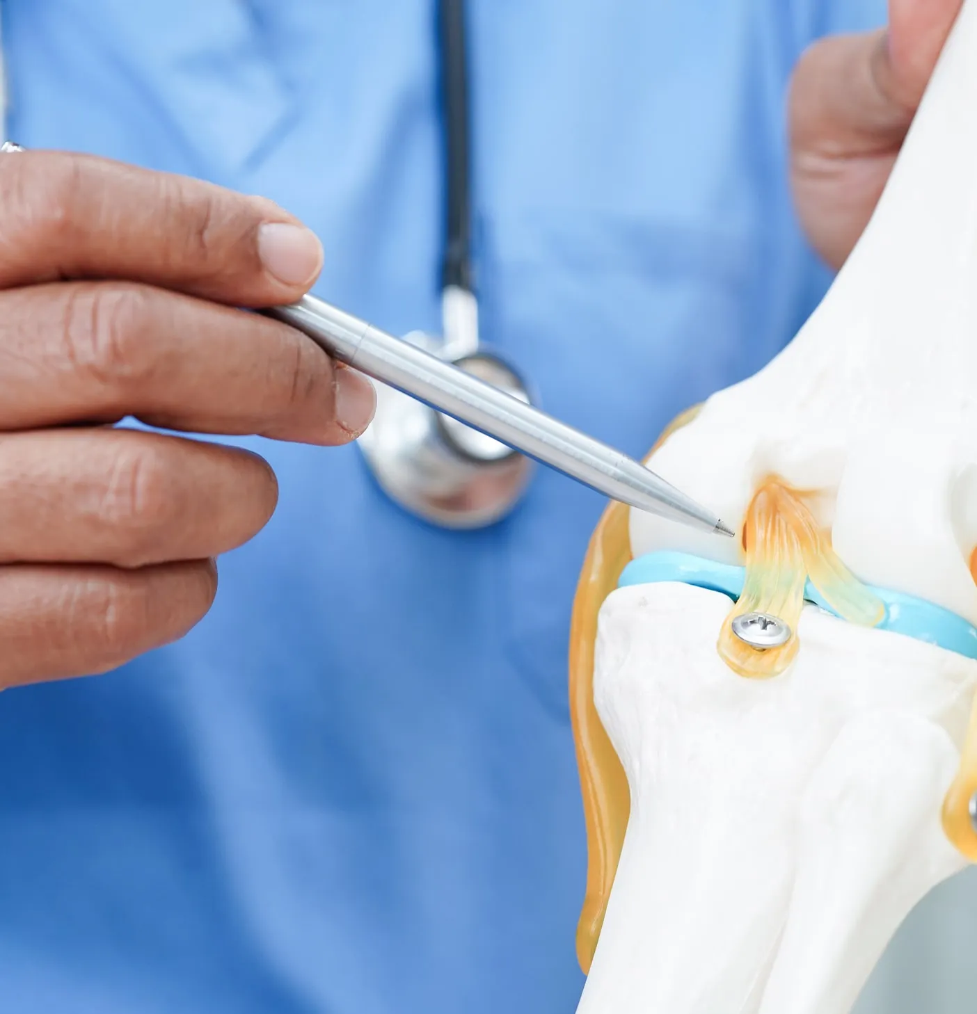 Un médecin indique avec un stylo un modèle anatomique de l'articulation du genou avec ligaments.