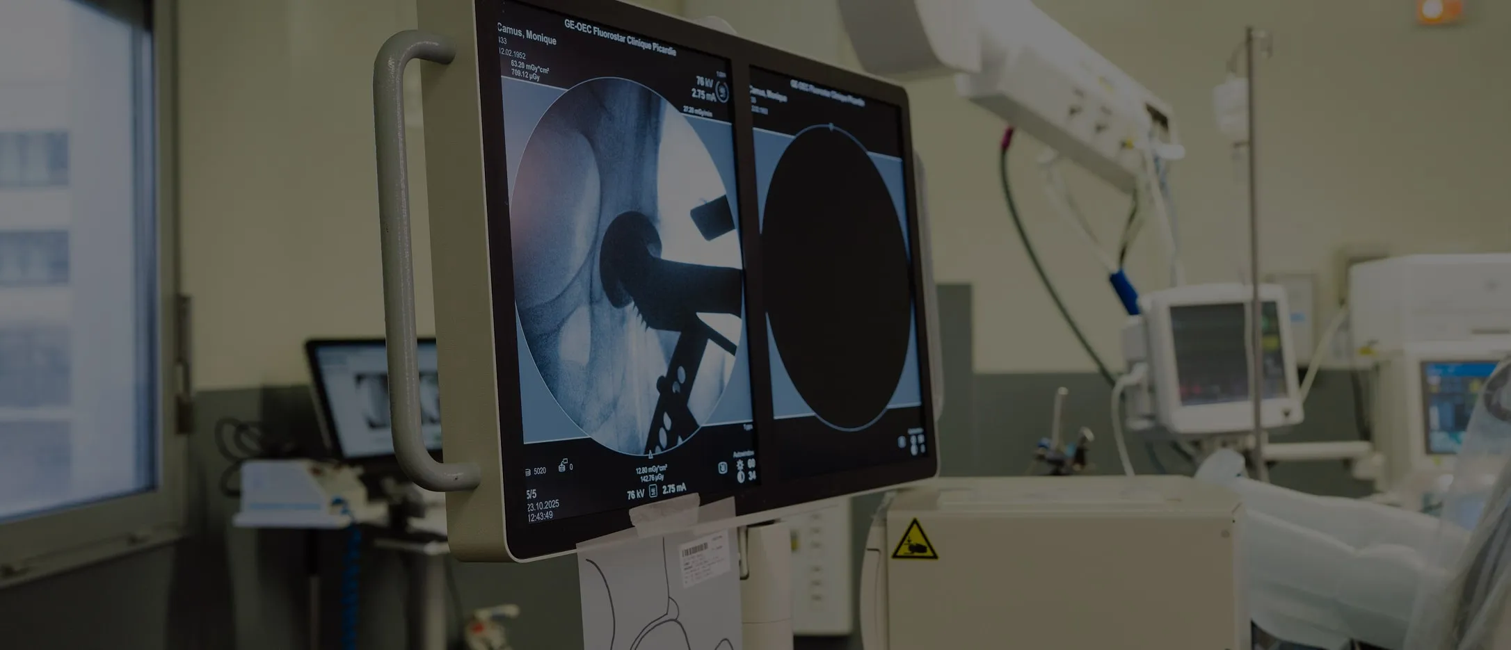 Écran affichant une radiographie d'une hanche avec prothèse dans une salle médicale.