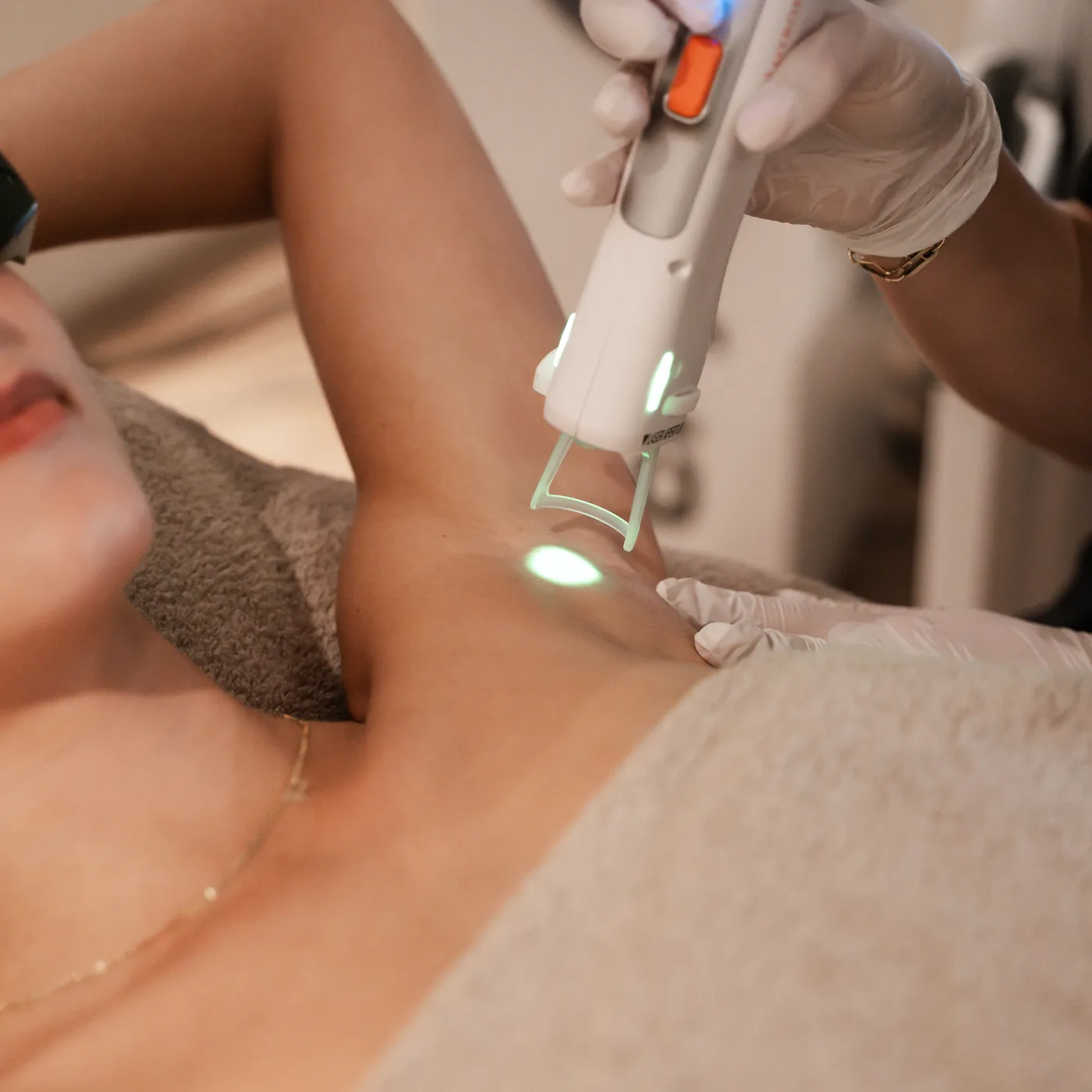 Close-up van een laserbehandeling bij ongewenste haargroei op de oksels