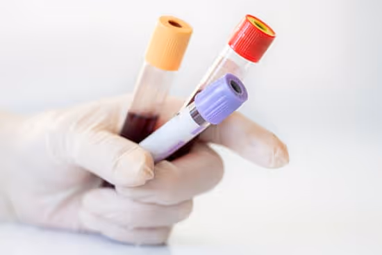 Hand wearing a glove holding three blood sample tubes with colored caps.