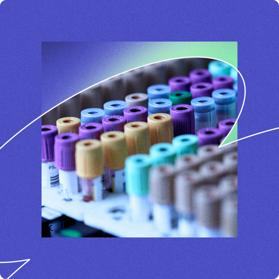 Rows of blood collection tubes with colored caps arranged in a rack, featuring purple, yellow, blue, green, and tan caps.