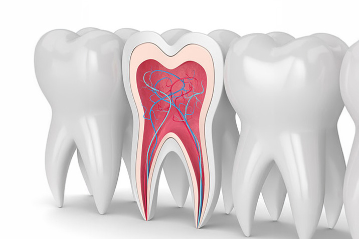 Root Canal Treatment