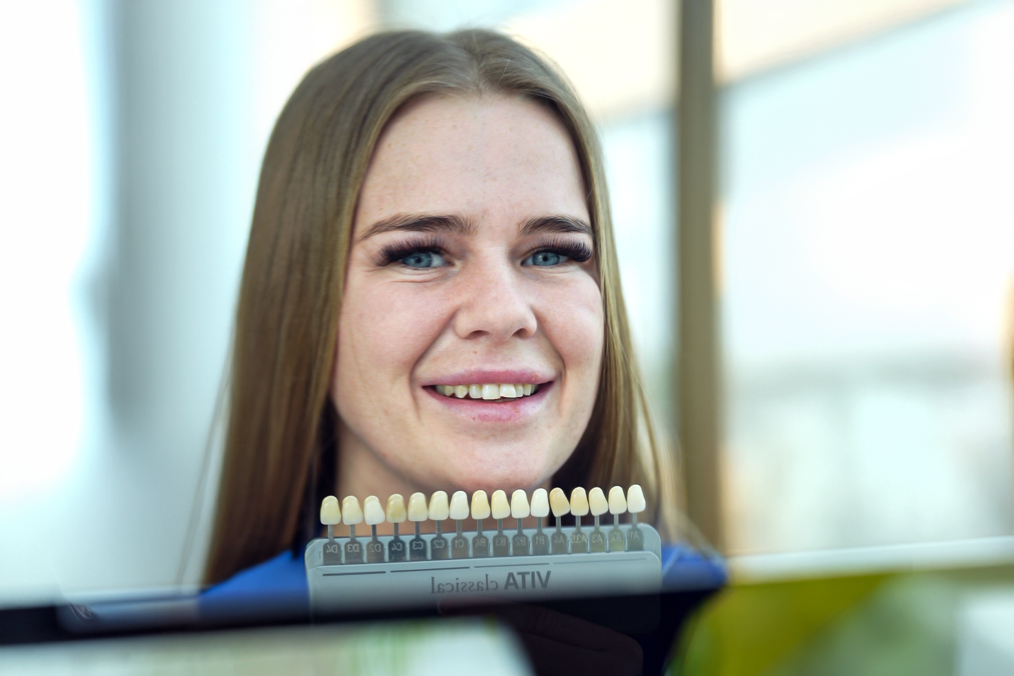 Minimal Prep Veneers