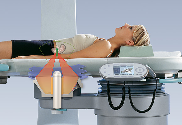 Extracorporeal shock wave lithotripsy (SWL)