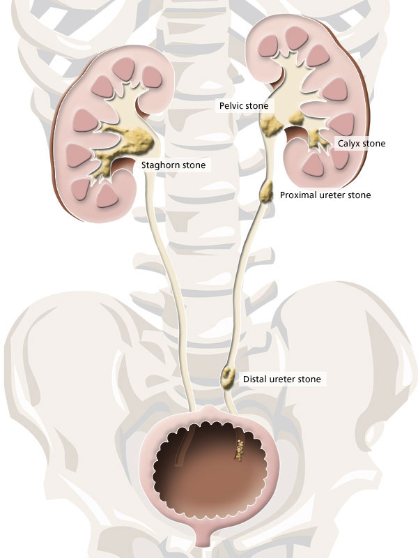 Kidney