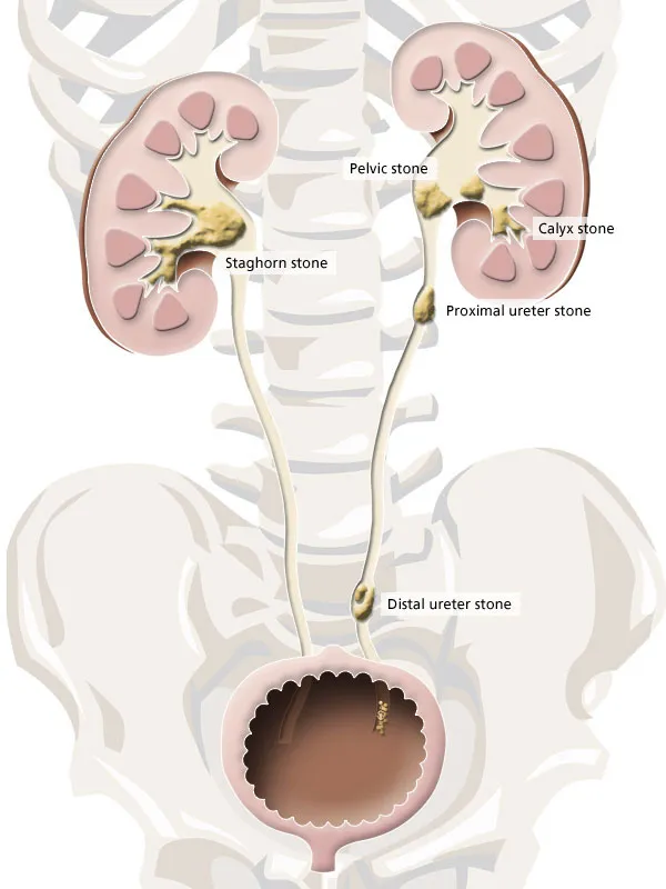 Kidney