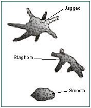 Kidney Stones