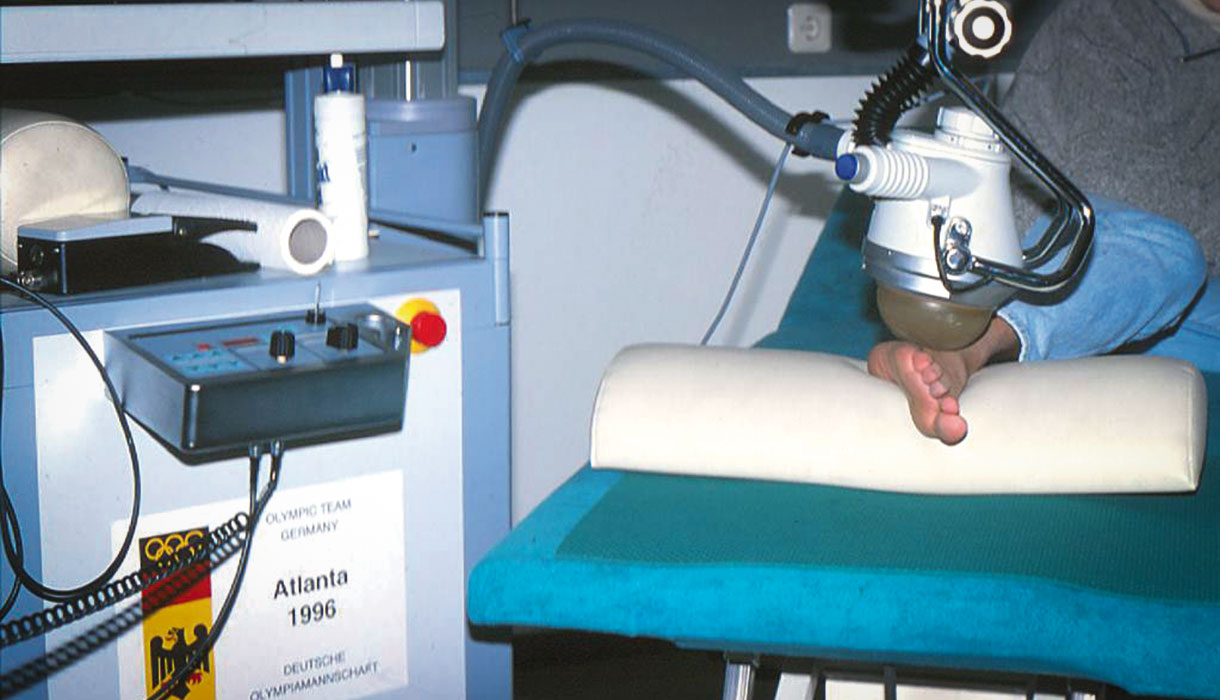 History of shock wave therapy