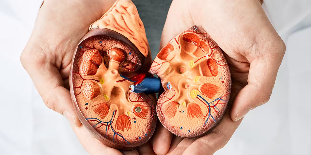 Illustration representing kidney stones in adults