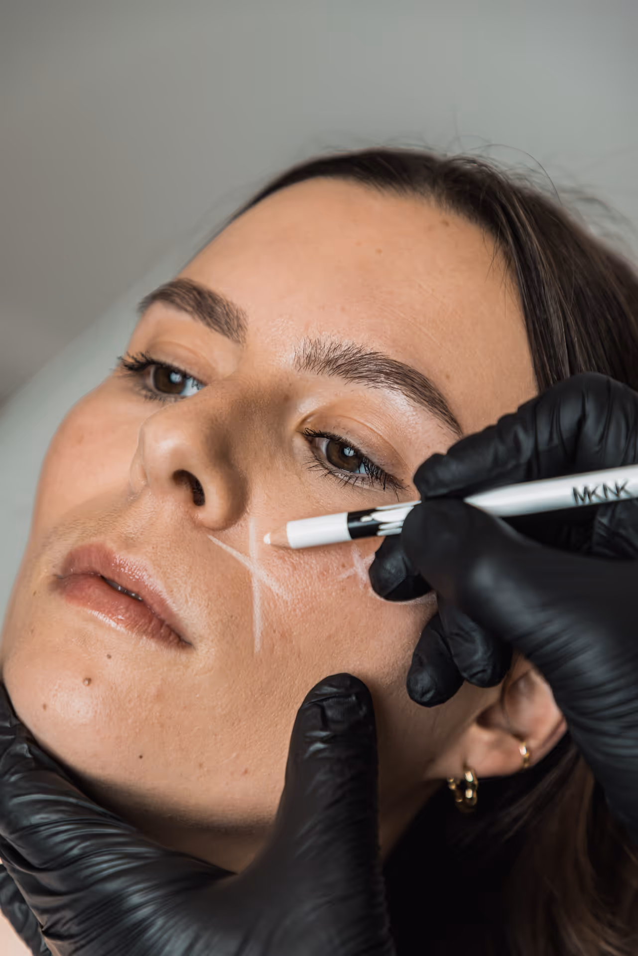 Le Dr Fulmart Reboux portant des gants noirs dessine des traits blancs sur la joue d'une femme pour préparer un traitement du visage.