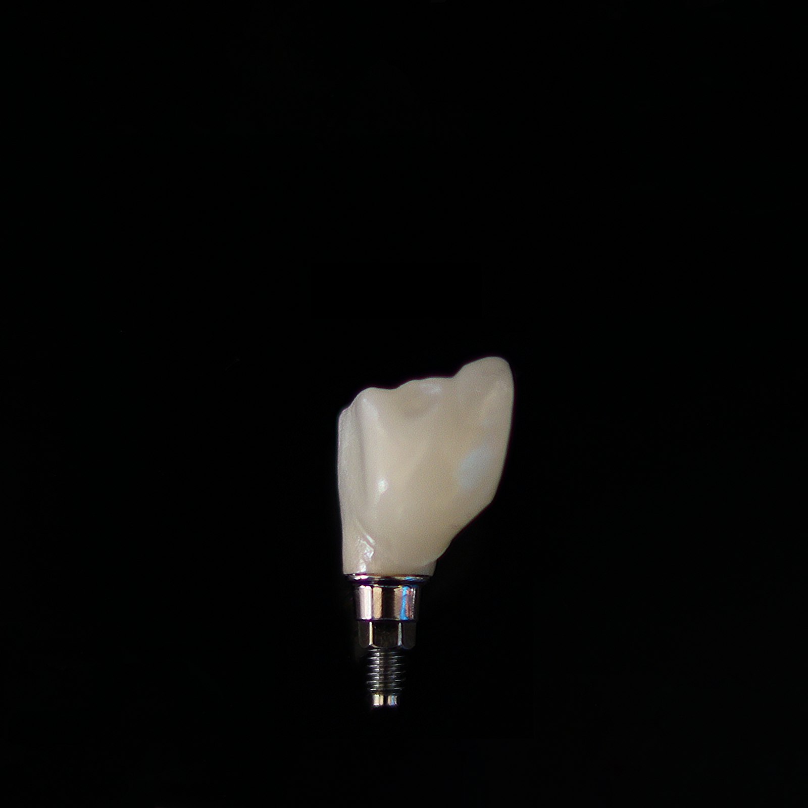 Same-Day Dental Implants in Sydney: How Immediate-Load Implants Work