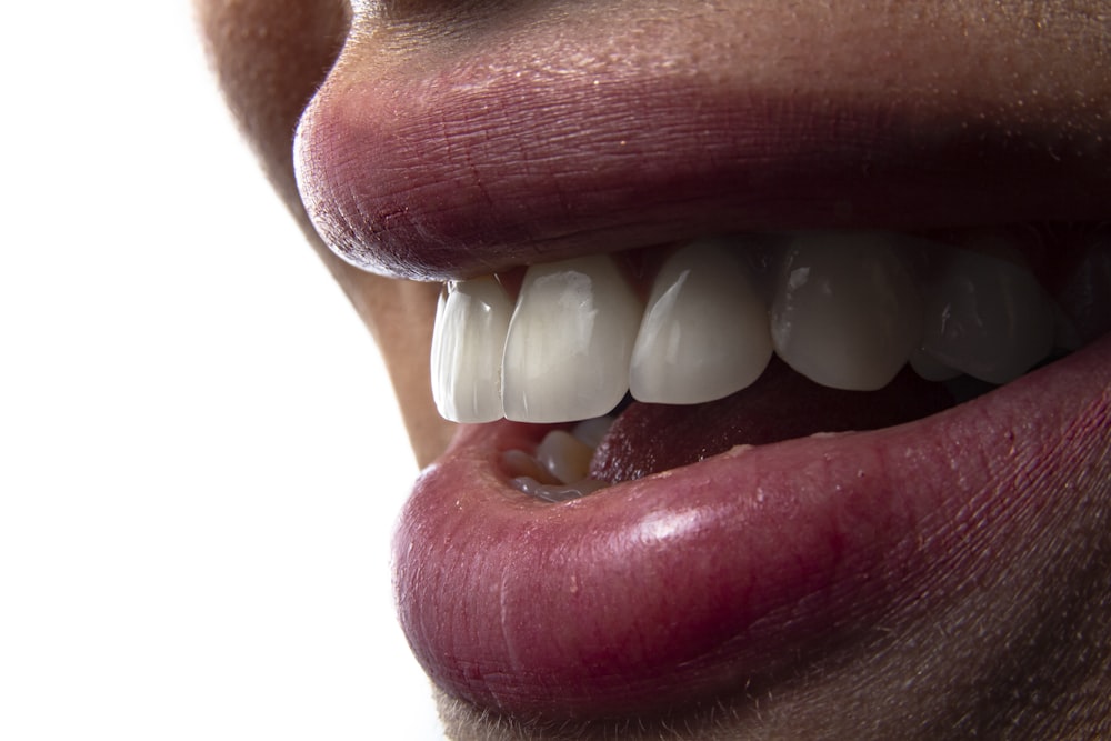 Adult comparing Invisalign clear aligners vs braces treatment options