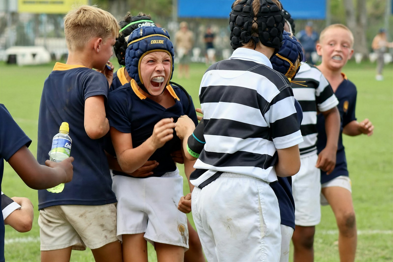Mouthguards With Braces: What Kids Need for Sport