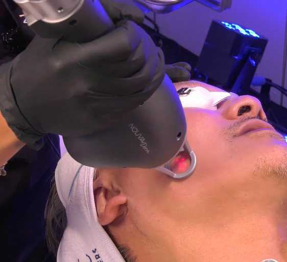 Nouvaderm Laser
