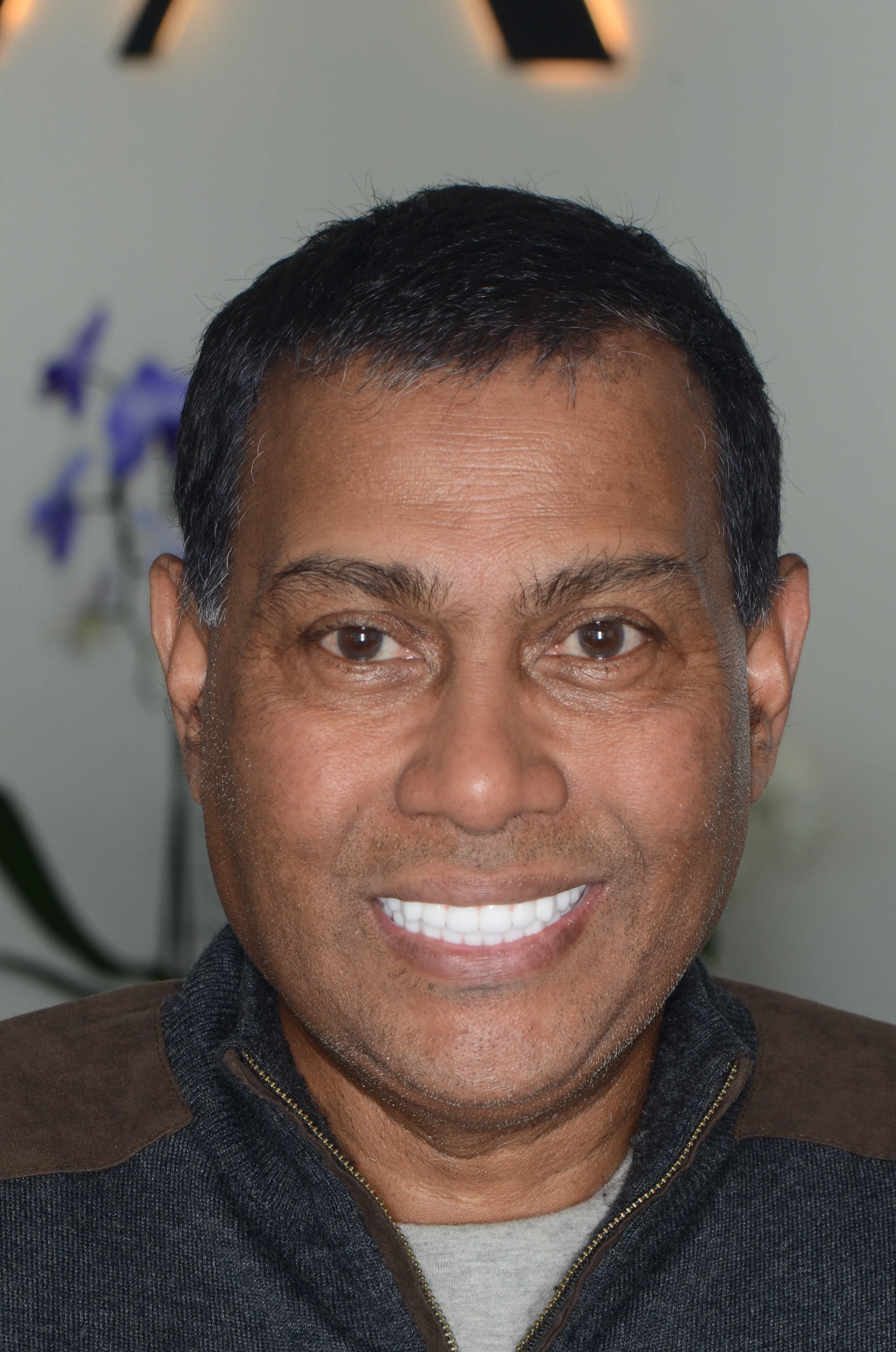 After: balanced gum line after esthetic crown lengthening by Dr. Rafik Dib