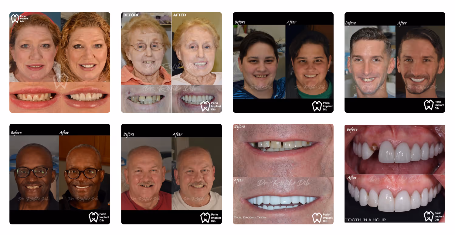 Smile transformations at AVA