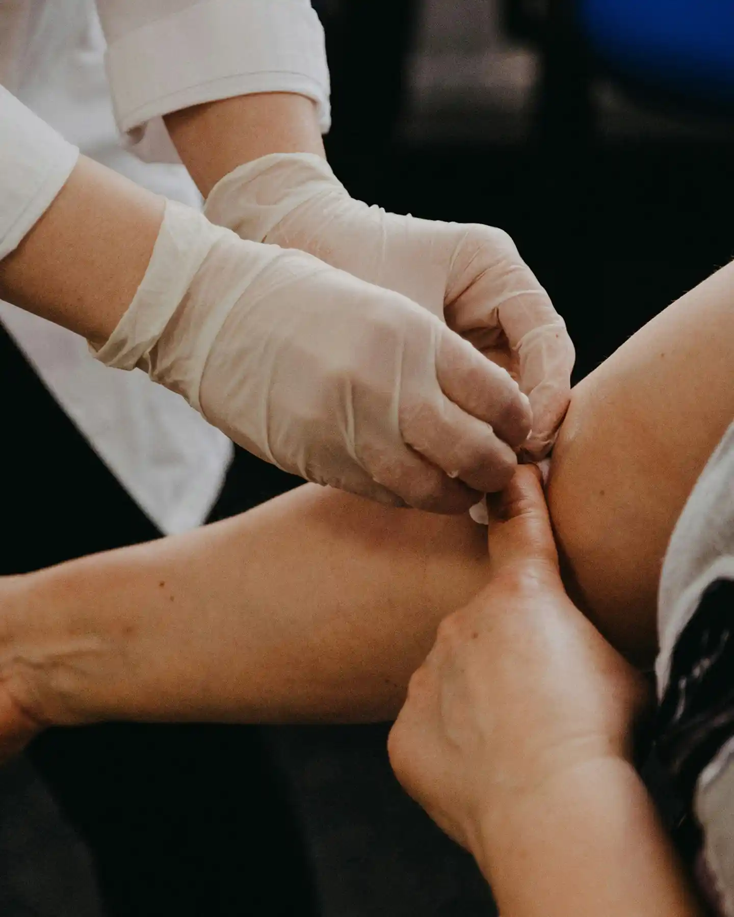A healthcare professional wearing gloves preparing a patient's arm for a blood draw.