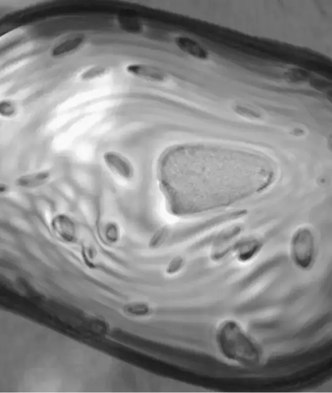 Black and white microscopic close-up of a plant cell showing the central vacuole and surrounding organelles.