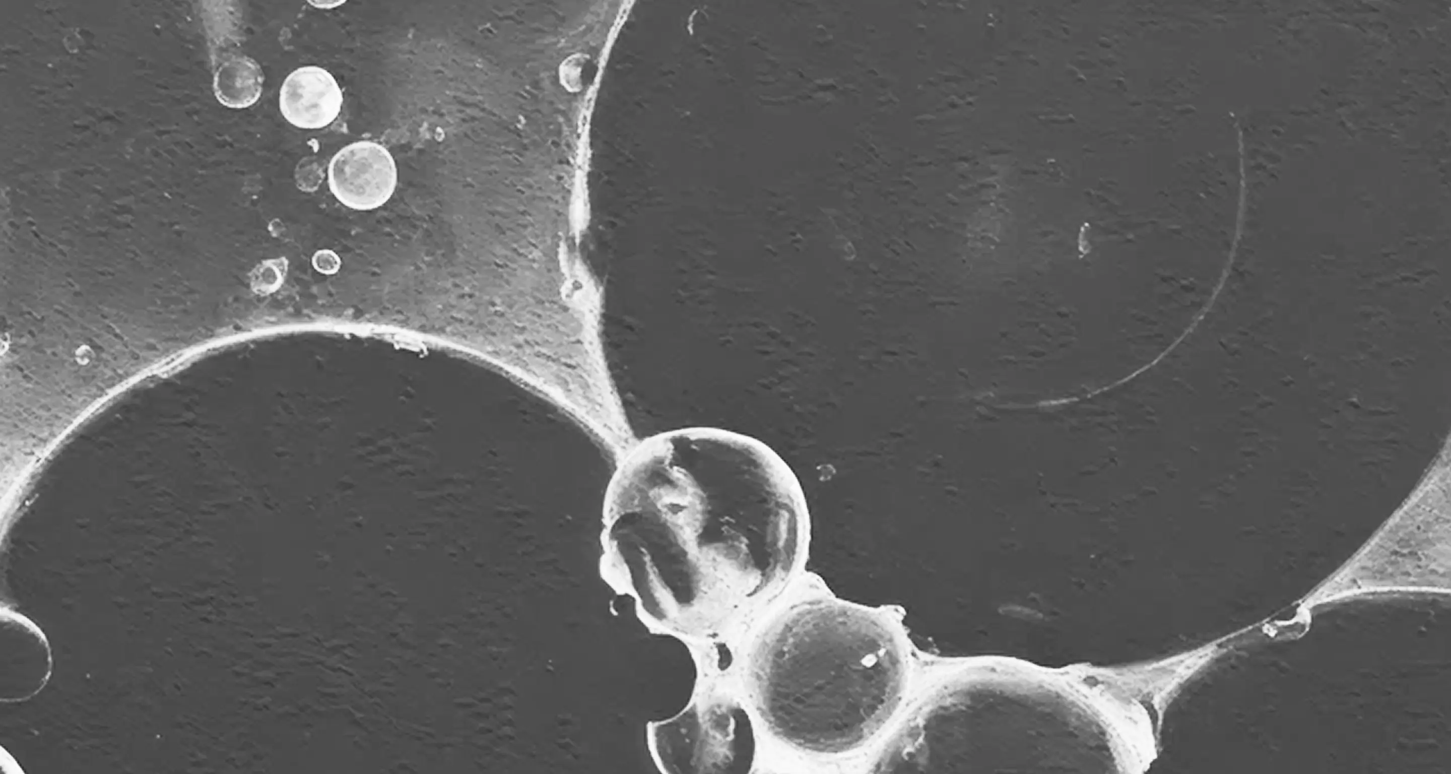 Close-up of translucent bubbles clustered together against a textured dark background.