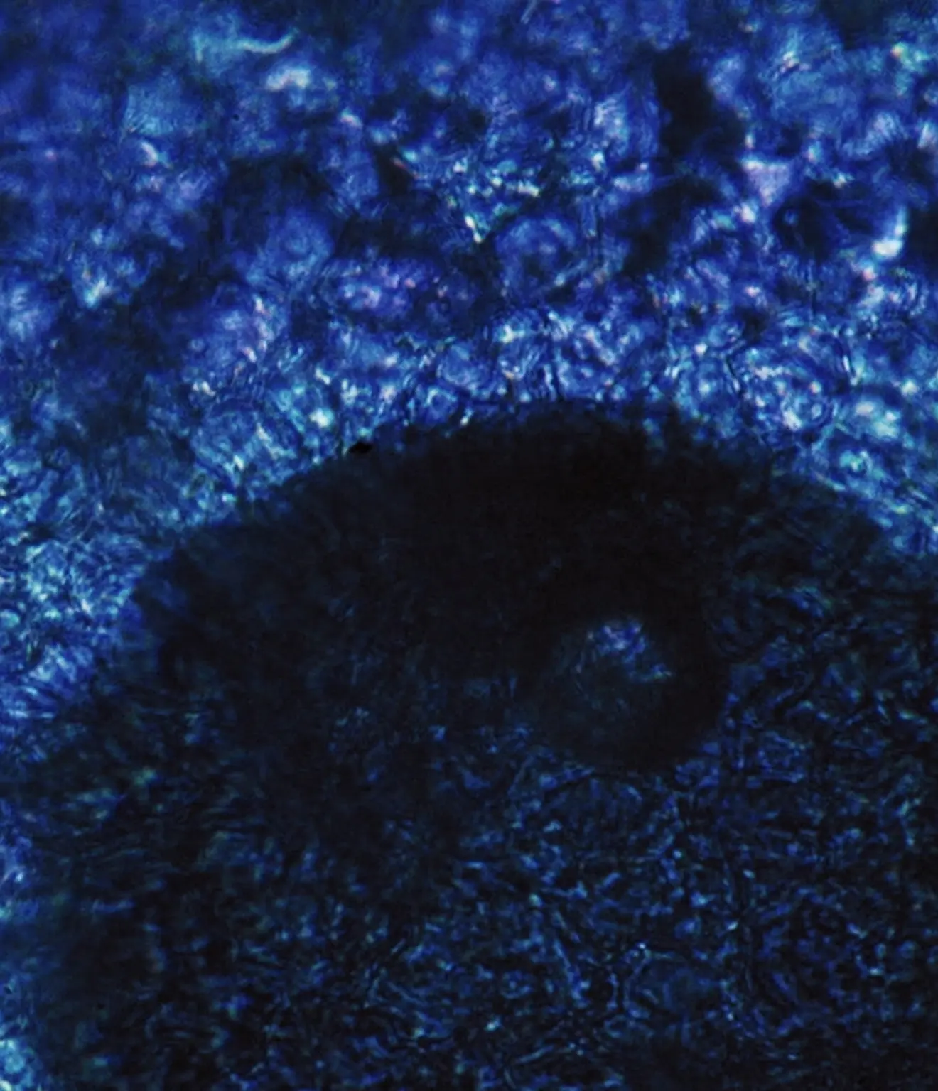Close-up of a dark, translucent microscopic texture with intricate, swirling blue patterns.