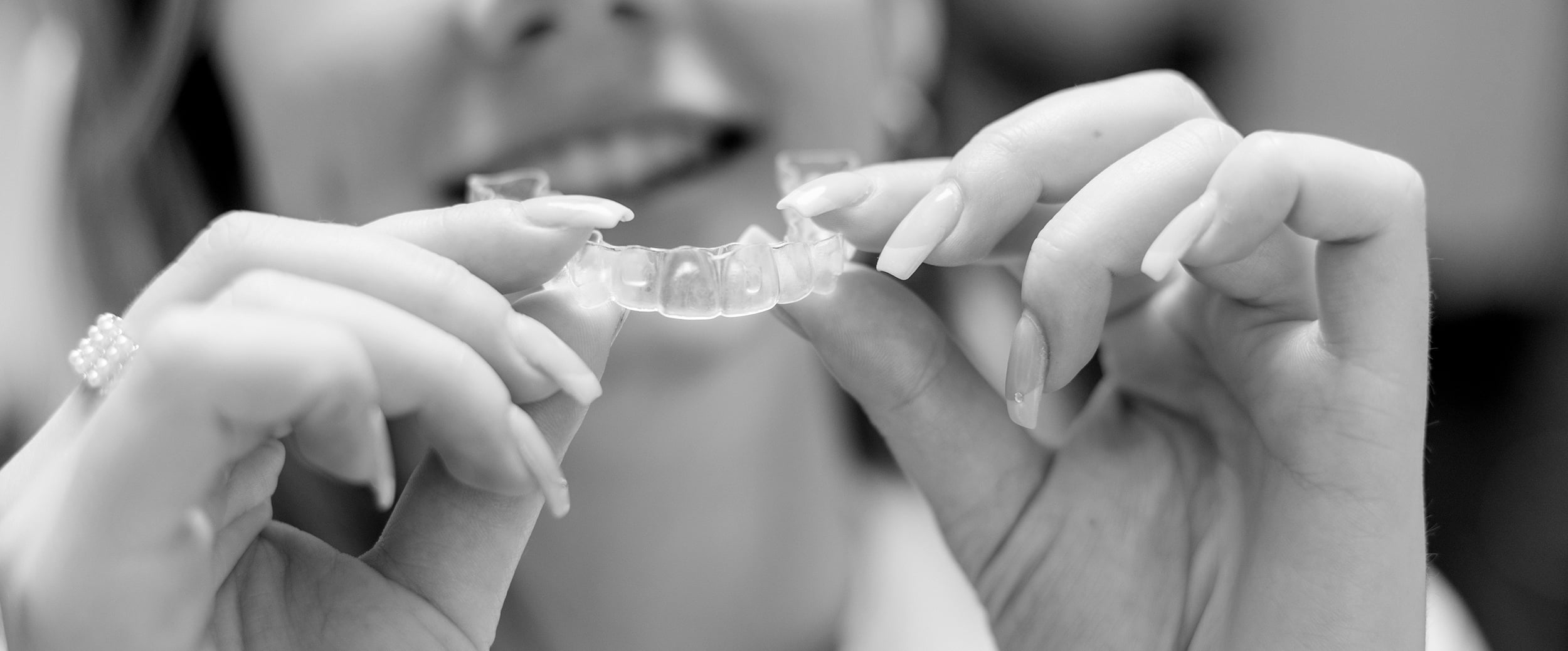 SPARK® & INVISALIGN® 