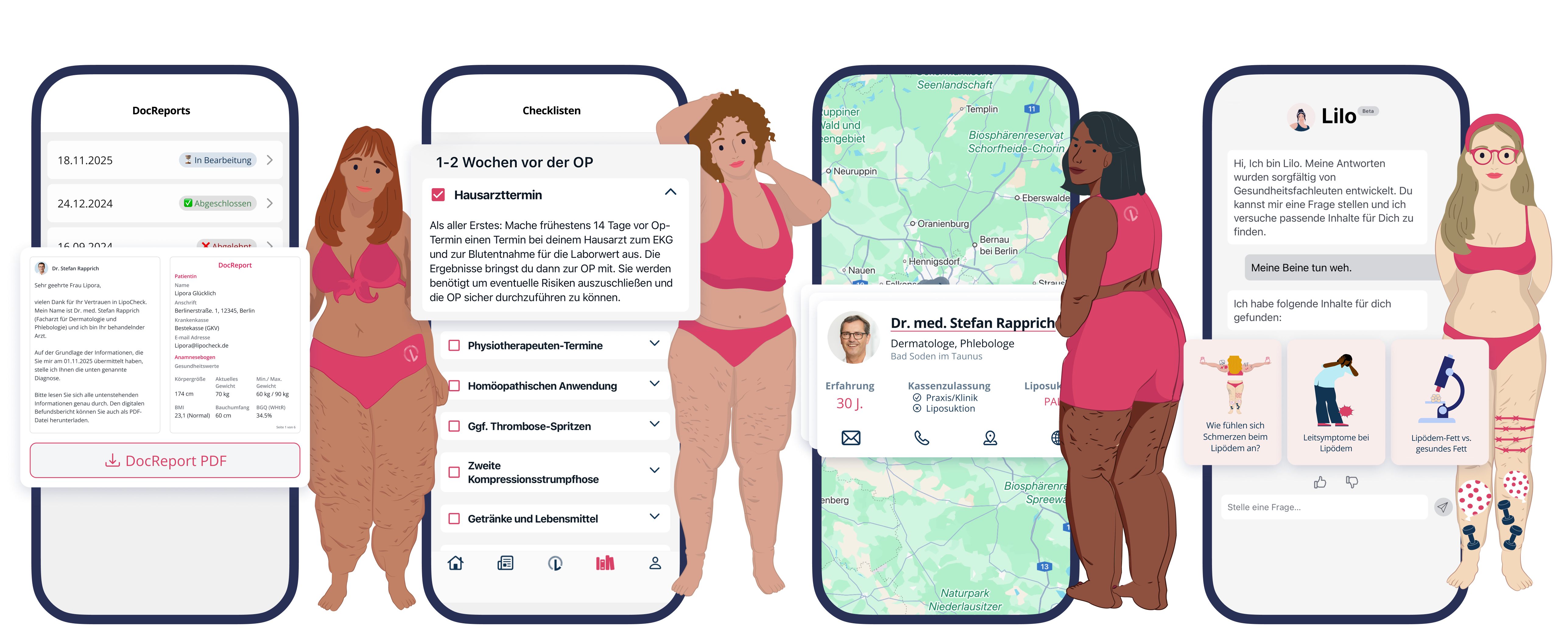 Four illustrated women of varying body types and skin tones stand beside smartphone screens showing a health app with features like DocReports, checklists before surgery, doctor profiles on a map, and a chatbot named Lilo providing lipedema-related information.