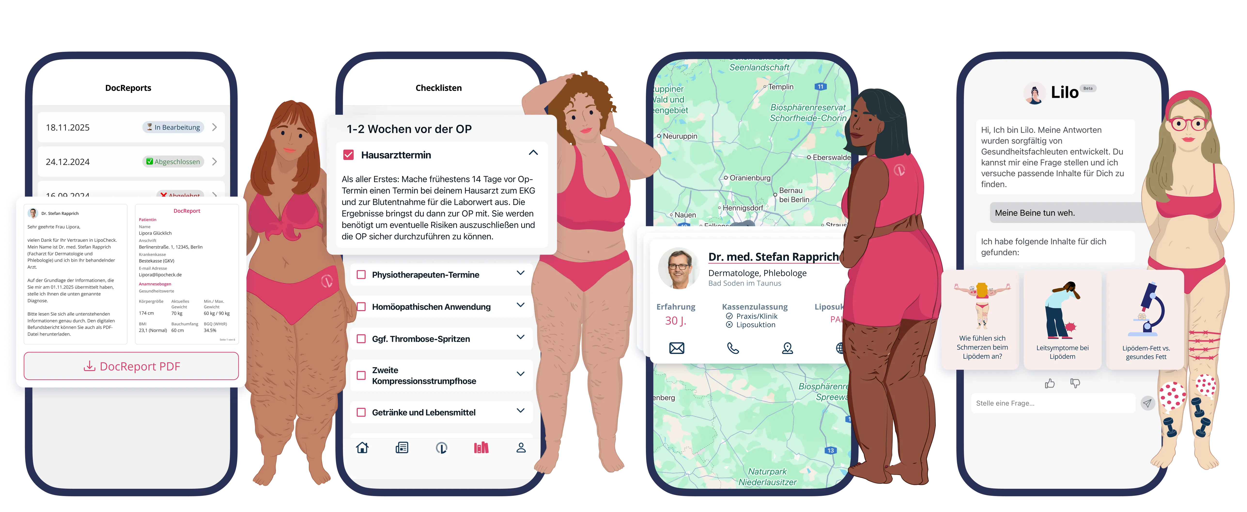 Four illustrated women of varying body types and skin tones stand beside smartphone screens showing a health app with features like DocReports, checklists before surgery, doctor profiles on a map, and a chatbot named Lilo providing lipedema-related information.