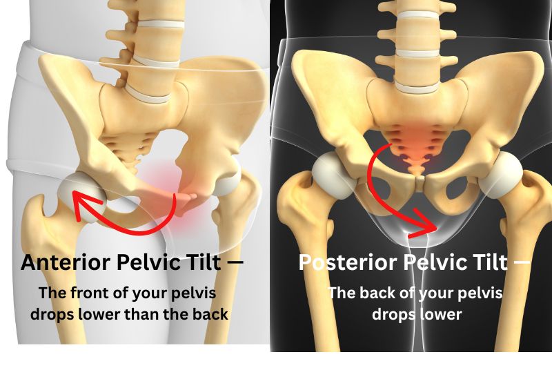 Pelvic Tilt