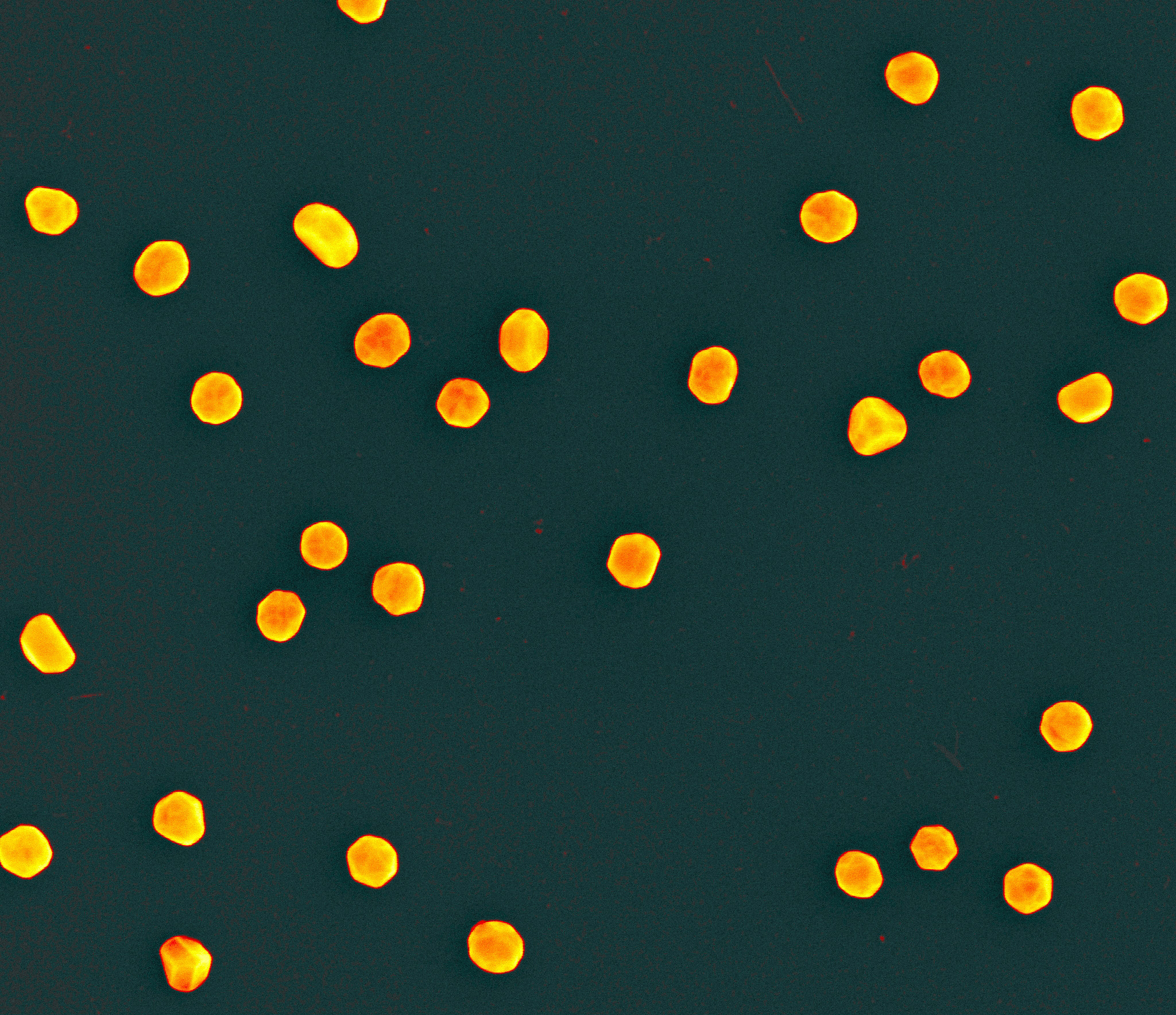 Scanning electron micrograph showing scattered, irregularly shaped yellow-orange nanoparticles on a dark background.