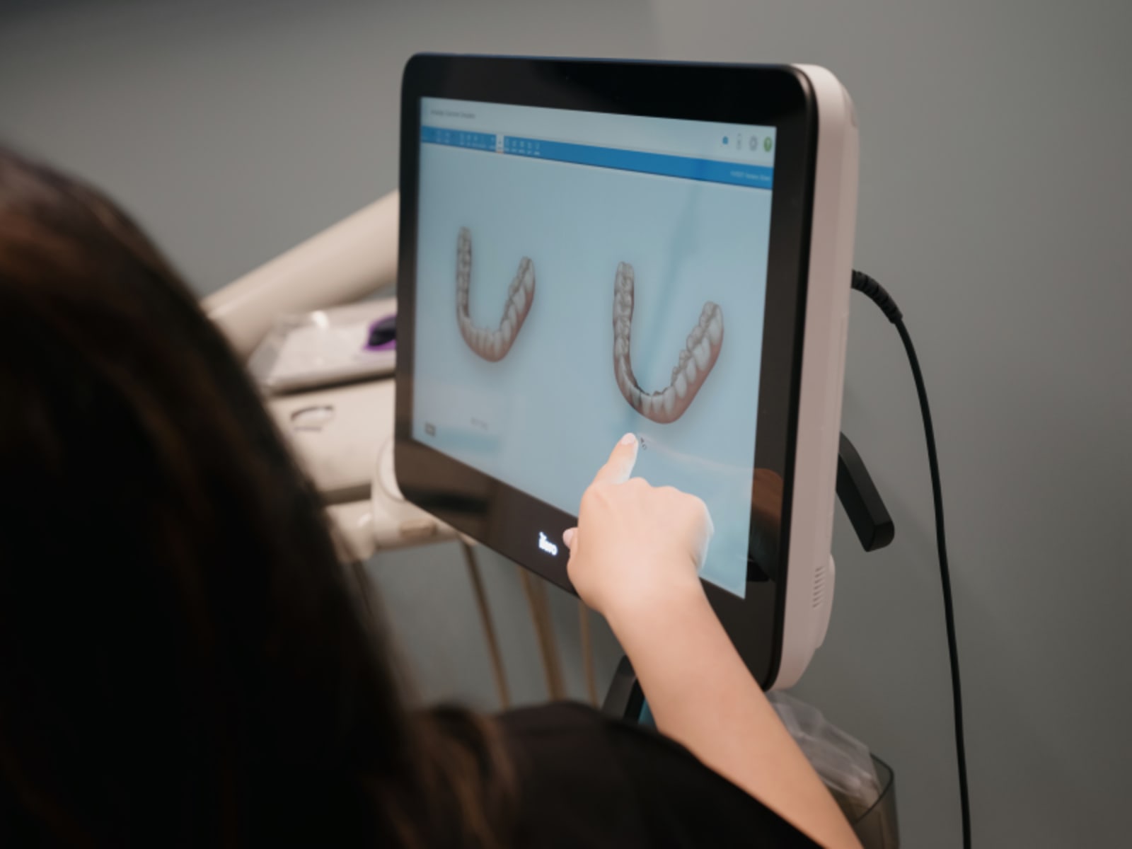 Patient examining Invisalign treatment plan on digital tablet with dental images displayed.