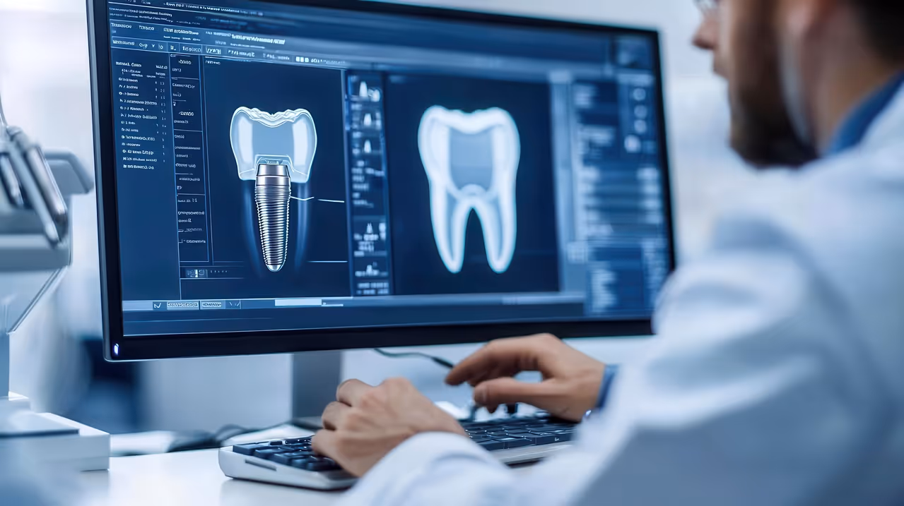 Computer-Guided Precision: Why Technology Matters for Your Dental Implant