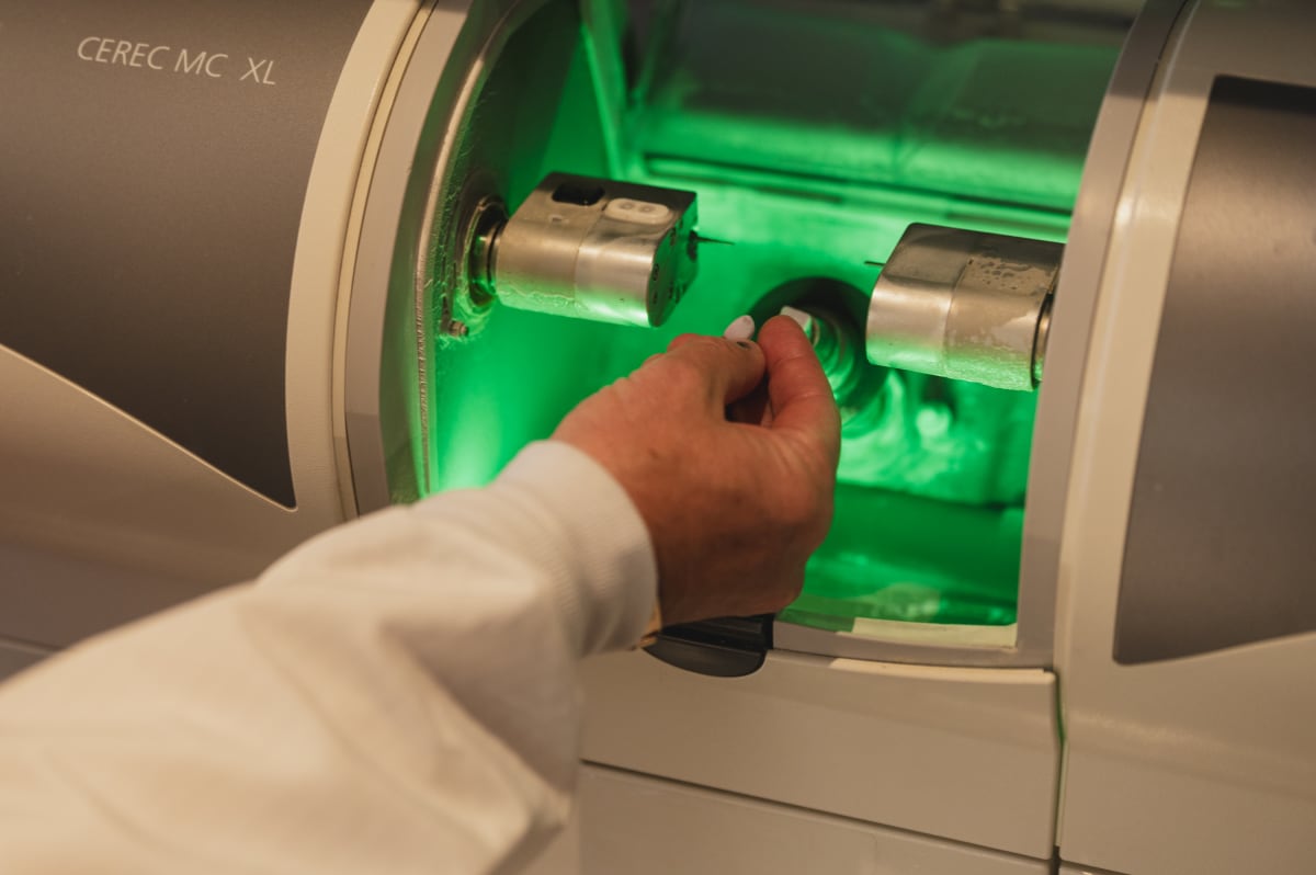 Dentist's hands demonstrating dental scanning technology with green digital interface for crown imaging
