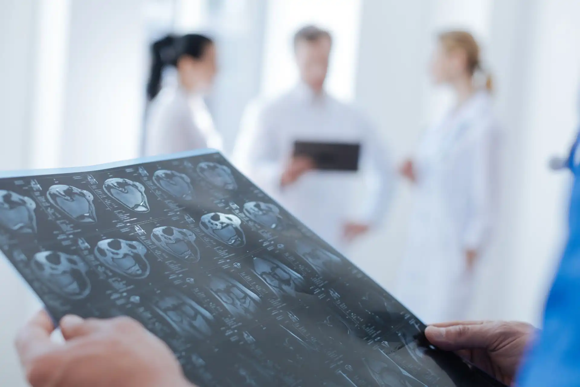 A medical professional holding and examining a CT scan image of a heart with three doctors blurred in the background.