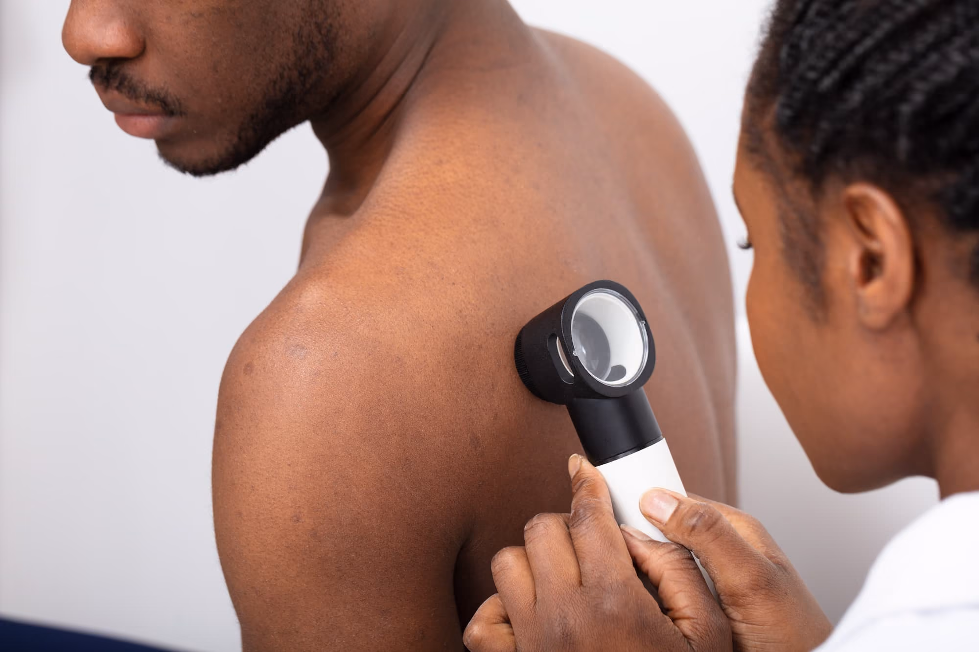 Healthcare professional examining a man's shoulder with a dermatoscope.