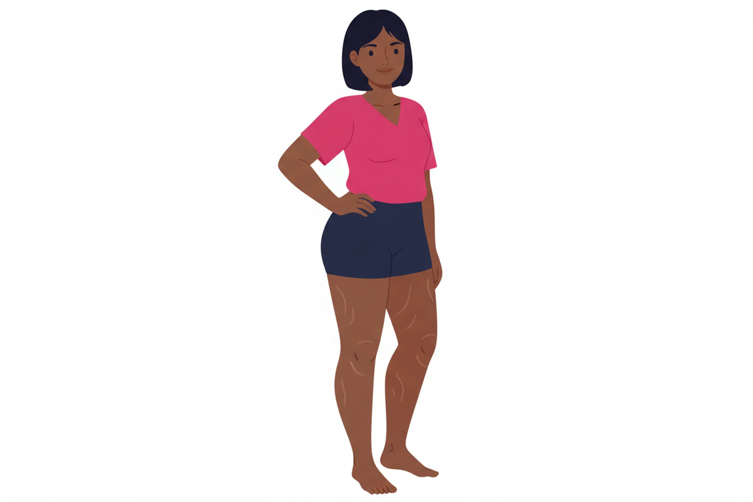 Illustration zum Thema Lipödem Risiko einschätzen: Der ultimative Selbsttest für zu Hause - LipoCheck Lipödem Magazin