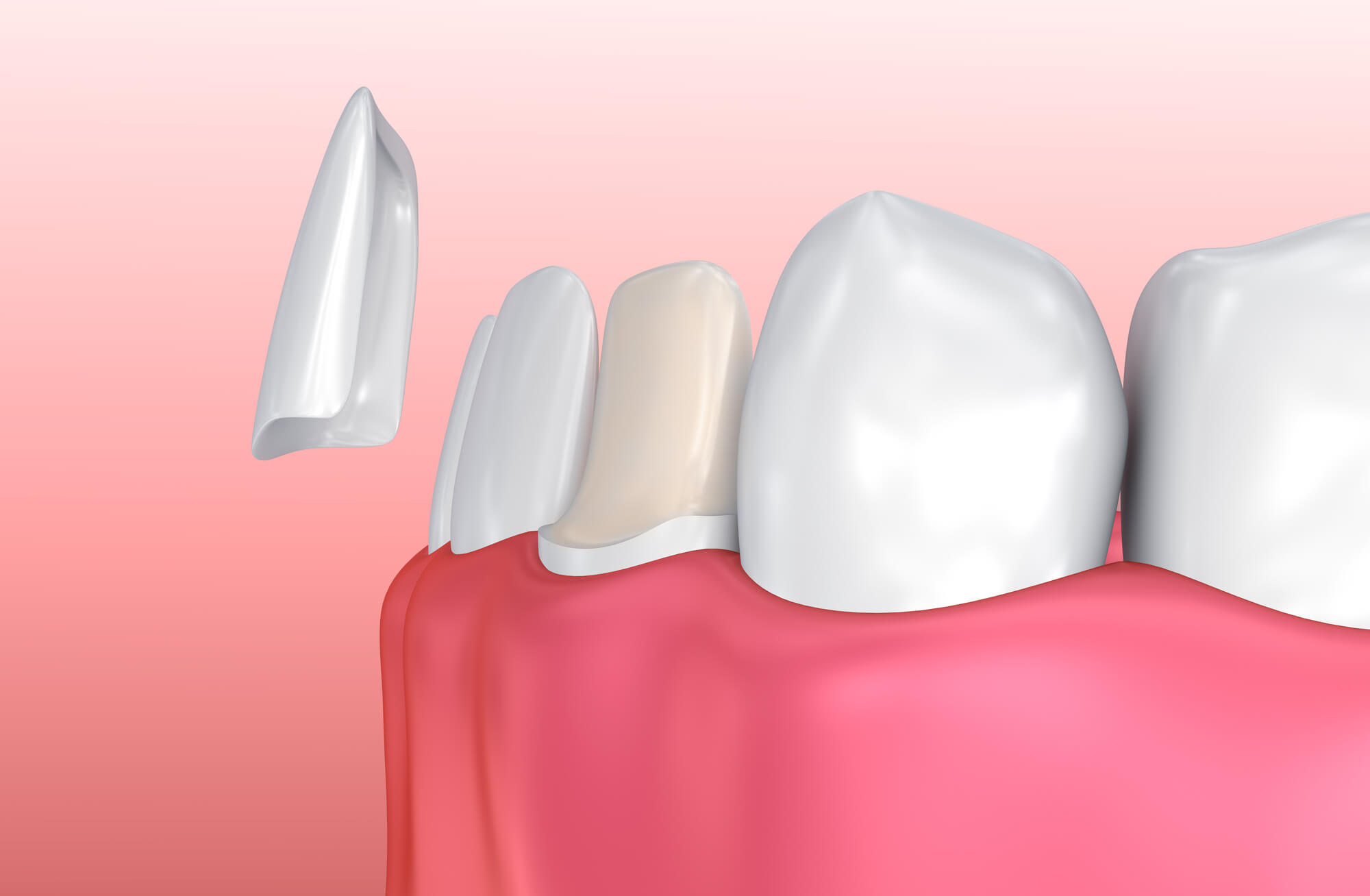 Where can I find Cosmetic Dentistry Winter Park?