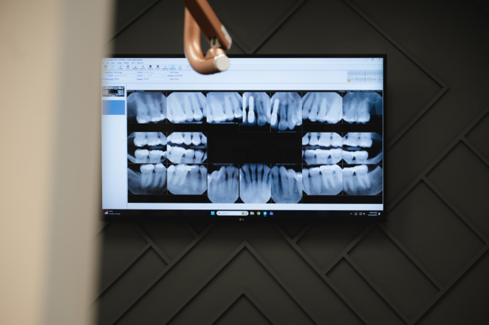 Modern dental chair in clinical treatment room with professional equipment and monitors