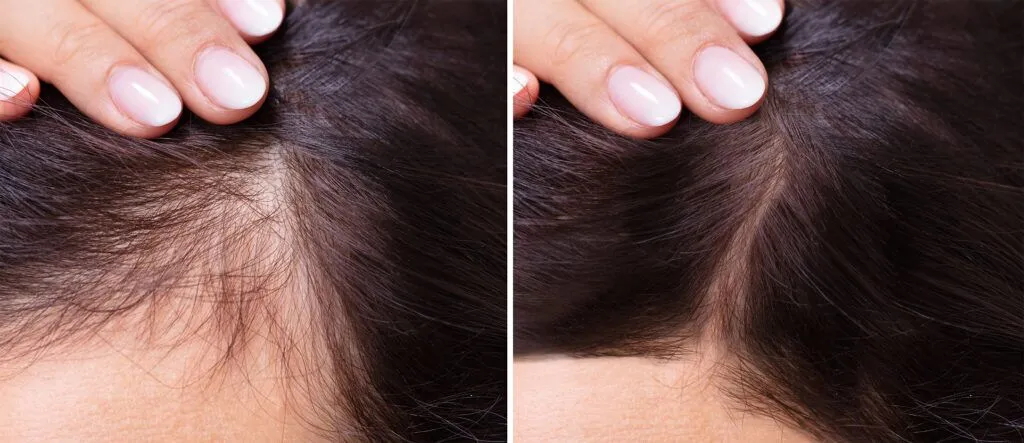 Illustration of HEPA filter trapping air contaminents