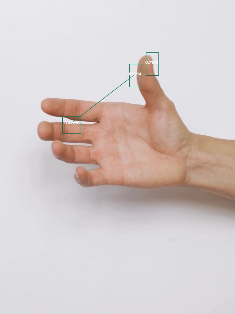 Open hand with green motion-tracking boxes over the fingers.