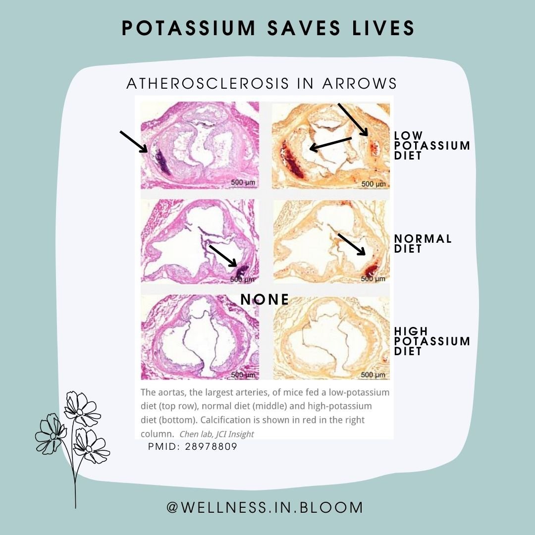 Potassium Rich Diets Have Less Atherosclerosis